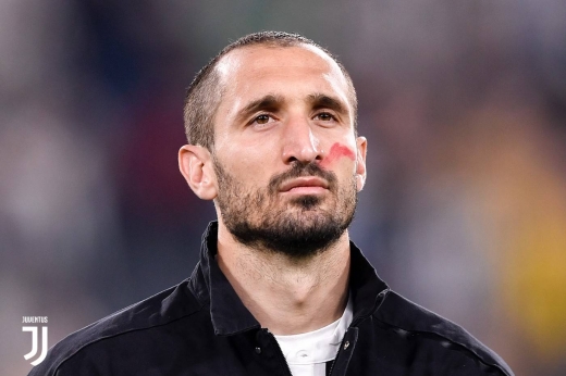 基耶利尼为什么叫椰子_焦尔焦基耶利尼外号椰子的原因